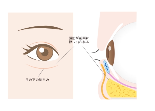 傷が見えないスタンダードな術式