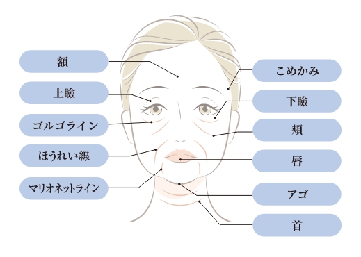 自身の脂肪を注入して、若々しい印象に